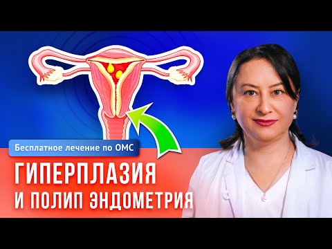 Видео: Первые тревожные признаки патологий матки — причины и лечение полипов и гиперплазии эндометрия