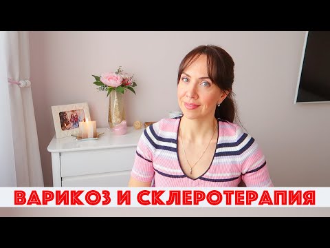 Видео: ВАРИКОЗ. Делаю СКЛЕРОТЕРАПИЮ ВЕН на НОГАХ. ЦЕНА процедуры. Мой ОПЫТ лазерной коагуляции вен