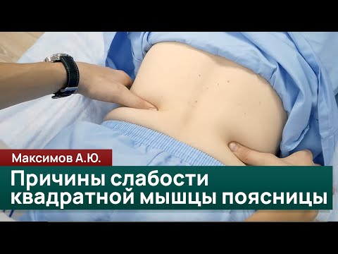 Видео: Диагностика квадратной мышцы поясницы и причины её слабости. Максимов А.Ю.