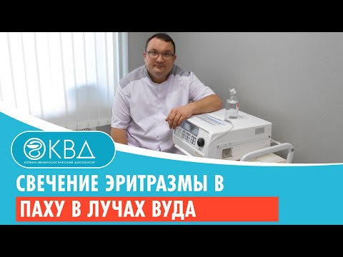 Видео: 💡 Свечение эритразмы в паху в лучах Вуда. Клинический случай №252