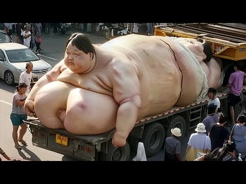 Видео: Не Жизнь а Ад! Это Самый Толстый Человек в Мире!