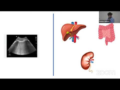 Видео: VEXUS – фокусный протокол для комплексной оценки венозного застоя в интенсивной терапии
