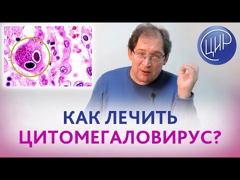 Видео: Цитомегаловирус. как лечить цитомегаловирус и влияет ли он на зачатие? Отвечает Гузов И.И.