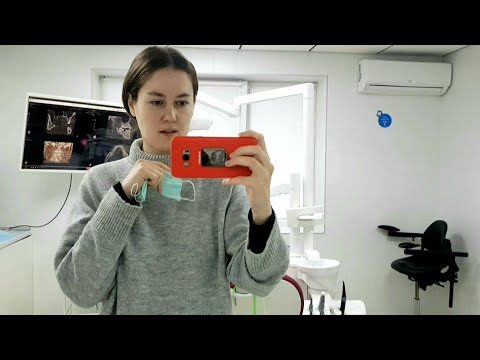 Видео: Зубной имплант. Моя история 💫 Это больно? Как долго? Дорого?