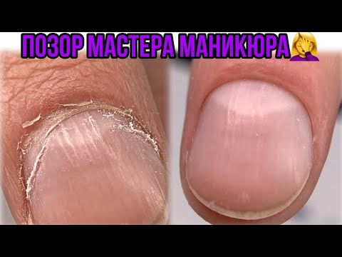 Видео: ПТЕРИГИЙ на пол ногтя😬Позор мастера маникюра😐Маникюр первый раз