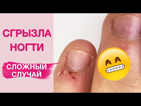 Видео: Заусенцы! Как НЕ грызть ногти? Наращивание БЕЗ форм