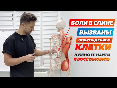 Видео: Суть лечения МиоФасциального синдрома. Что значит ЛЕЧИТЬ МЫШЦЫ?