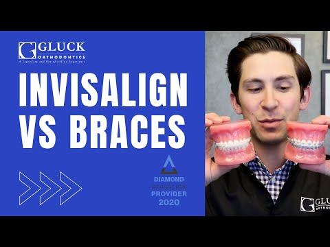 Видео: Invisalign против брекетов: советы сертифицированного ортодонта