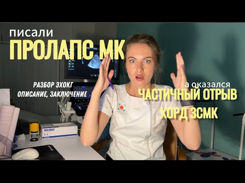 Видео: Писали ПРОЛАПС митрального клапана, а оказался ЧАСТИЧНЫЙ ОТРЫВ ХОРД! Эхокардиография. Разбор ЭхоКГ