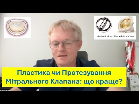 Видео: Пластика чи протезування мітрального клапана?