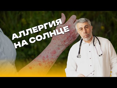 Видео: Аллергия на солнце