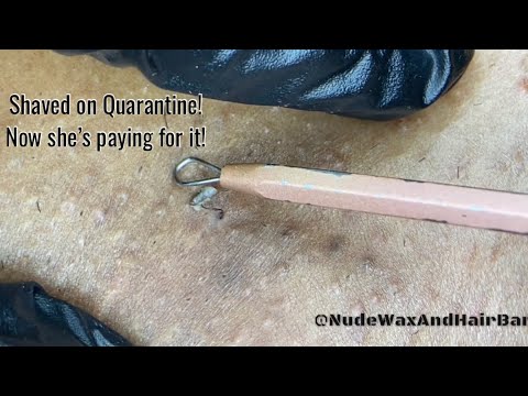 Видео: Бритье после депиляции воском! Больше всего черных точек мне удалось удалить у одного клиента!