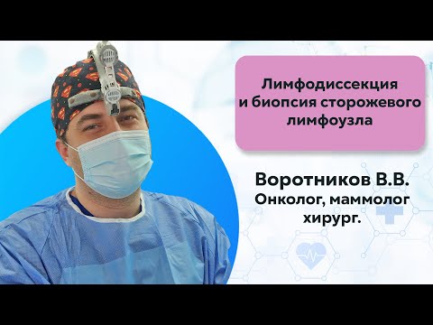 Видео: Лимфодиссекция и биопсия сторожевого лимфоузла