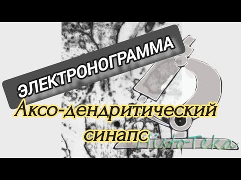Видео: АКСО-ДЕНДРИТИЧЕСКИЙ СИНАПС (электронограмма)