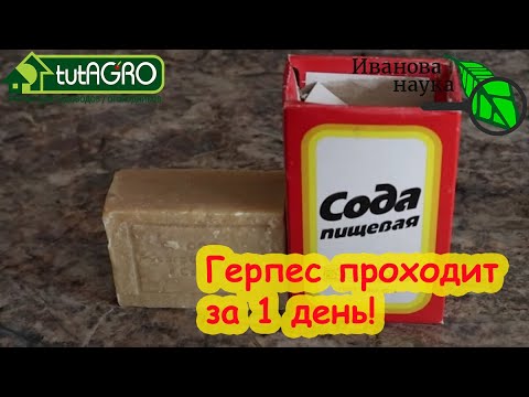 Видео: 6 СПОСОБОВ ИЗБАВИТЬСЯ ОТ ПРОСТУДЫ НА ГУБАХ БЕЗ ТАБЛЕТОК и МАЗЕЙ. Герпес исчезает и не возвращается.