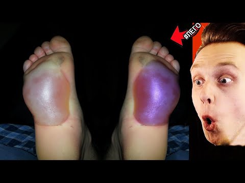 Видео: Попробуй не скажи ОЙ! / РЕАКЦИЯ на САМОЕ НЕ ПРИЯТНОЕ ВИДЕО на ПЛАНЕТЕ