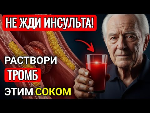 Видео: Главный ВРАГ Тромбов НАЙДЕН! 1 стакан этого красного сока, и кровь станет жидкой как родниковая вода