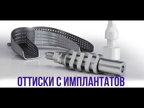 Видео: Способы получения оттисков с имплантатов