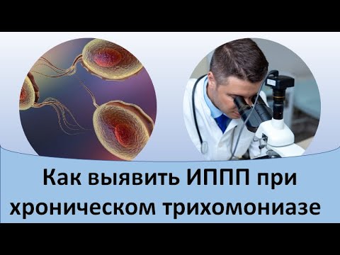 Видео: Как выявить ИППП при хроническом трихомониазе