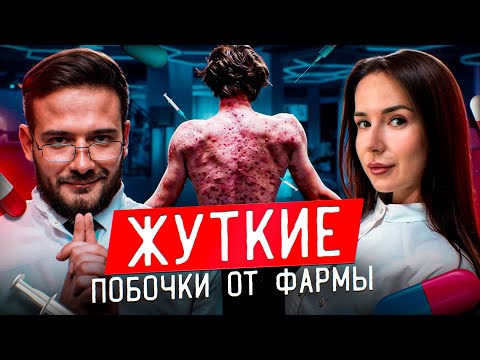 Видео: ПОБОЧКИ ОТ СТЕРОИДОВ | ПОБОЧНЫЕ ЭФФЕКТЫ ОТ ФАРМЫ