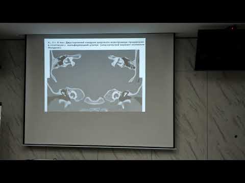 Видео: Актуальные вопросы практической оториноларингологии - Практические вопросы клинической аудиологии