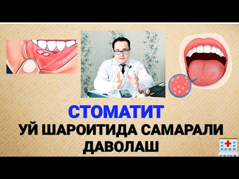 Видео: СТОМАТИТ ХАҚИДА БАФУРЖА МАЪЛУМОТ ВА УЙ ШАРОИТИДА САМАРАЛИ ДАВОЛАШ