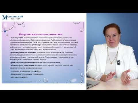 Видео: Рак молочной железы (РМЖ): клиника, диагностика, общие принципы лечения