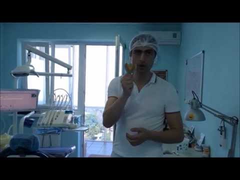 Видео: Изготовление ортодонтической капы