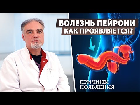 Видео: Что такое болезнь Пейрони и как её лечить?