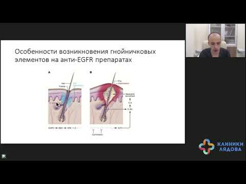 Видео: Побочные явления после таргетной терапии. Разговор с онкологом