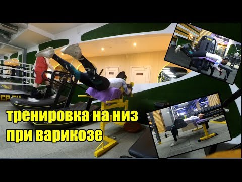 Видео: Варикоз не приговор! Тренировка на ноги и попу в тренажерном зале + растяжка при варикозе.