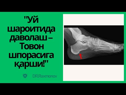 Видео: Товон шпораси: Оғриқдан қутулиш йўли!
