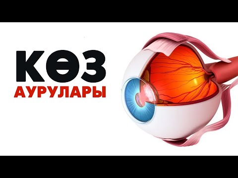 Видео: Көзілдірік тағу зиян ба? | #көз #окулист