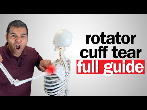 Видео: Разрыв вращательной манжеты плеча: все, что вам нужно знать [ПОЛНОЕ РУКОВОДСТВО 2024 ГОДА]