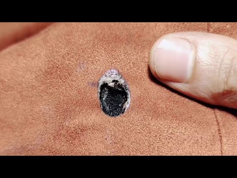 Видео: Как незаметно залатать дырку на куртке / Хранить одежду
