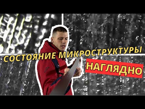 Видео: Структура наглядно! Питание под микроскопом #лыжнаямедиалига #подготовкалыж #лыжи #лыжники