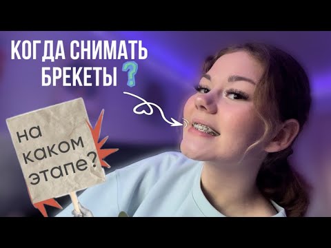 Видео: БРЕКЕТЫ/что меня ждет и когда снимут брекеты 😬🦷