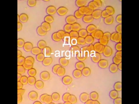 Видео: Проглотил 6 таблеток с L-ARGININ и вот, что случилось с кровью