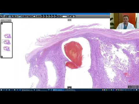 Видео: Практикум к теме онкопатология. Введение