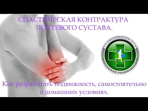Видео: Спастическая контрактура локтевого сустава. Как разработать в домашних условиях самостоятельно.