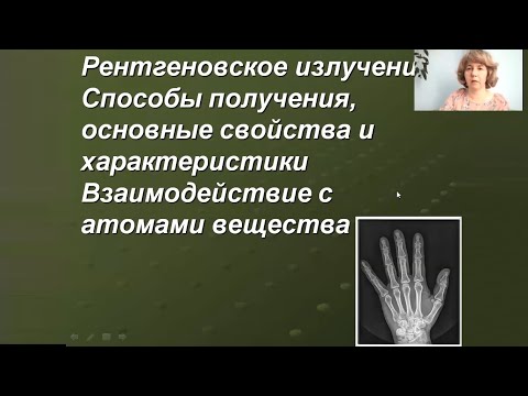 Видео: МФМ 9 - Рентгеновское излучение