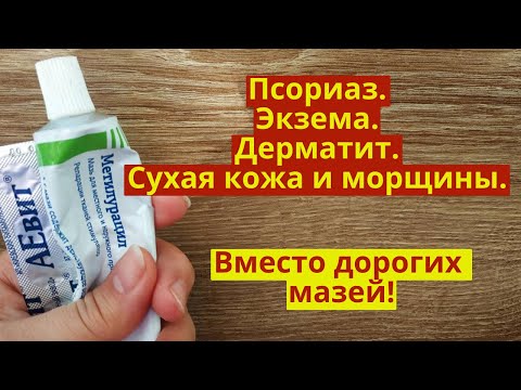 Видео: Лечит и омолаживает. Псориаз, экзема, дерматит, сухая кожа и морщины!