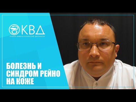 Видео: 1404  Болезнь и синдром Рейно на коже