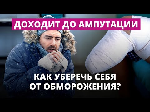 Видео: Мороз ушел, обморожения остались: в Ожоговом центре наплыв пациентов
