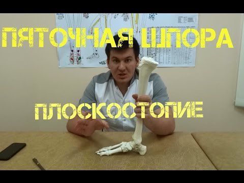 Видео: Как стопа влияет на все мышцы и позвоночник. Пяточная шпора, плоскостопие.