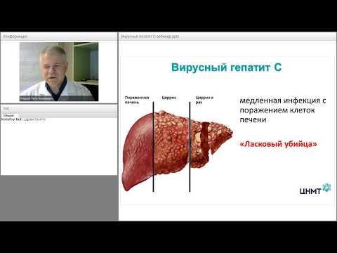 Видео: Вебинар: «Вирусный гепатит С на современном этапе».