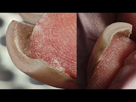 Видео: Минутный способ поднятия клюющих ногтей 😱коррекция нарощенных ногтей