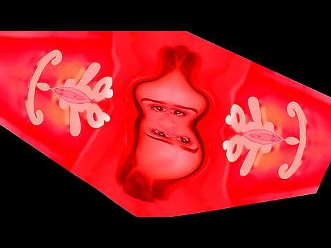 Видео: МБ Пакет - Как я к психиатру ходил