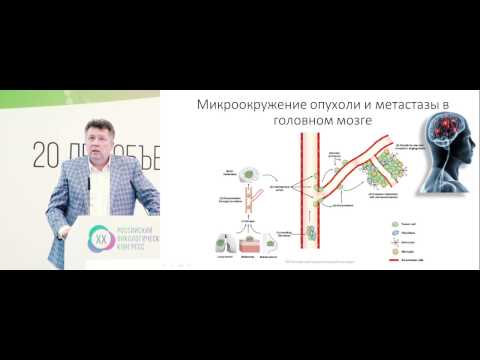 Видео: Немелкоклеточный рак легкого с метастазами в головной мозг. Облучение всего головного мозга