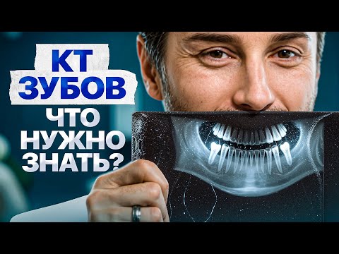 Видео: ВСЁ о компьютерной томографии ЗУБОВ простыми словами за 15 МИНУТ